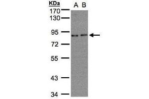 WB Image Sample(30 ug whole cell lysate) A:A431, B:H1299 7. (ZER1 抗体  (C-Term))