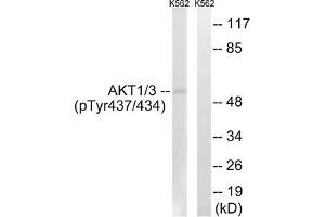 Western blot analysis of extracts from K562 cells, treated with insulin (0. (AKT1/3 (pTyr437) 抗体)