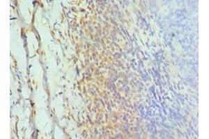 Immunohistochemistry of paraffin-embedded human tonsil tissue using ABIN7154323 at dilution of 1:100 (Golgin A2 (GOLGA2) (AA 20-300) 抗体)