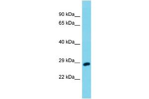 Host: Rabbit Target Name: Uchl3 Sample Type: Mouse Testis lysates Antibody Dilution: 1. (UCHL3 抗体  (Middle Region))