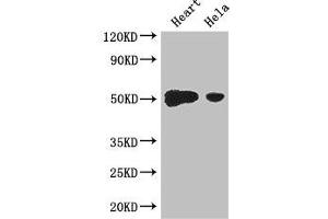 Western Blot Positive WB detected in: Mouse heart tissue, Hela whole cell lysate All lanes: TFDP2 antibody at 3.