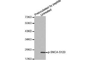 Western Blotting (WB) image for anti-Synuclein, alpha (SNCA) (pSer129) antibody (ABIN3020490) (SNCA 抗体  (pSer129))
