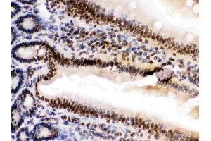 HMGB2 was detected in paraffin-embedded sections of mouse intestine tissues using rabbit anti- HMGB2 Antigen Affinity purified polyclonal antibody (Catalog # ) at 1 µg/mL. (HMGB2 抗体  (N-Term))
