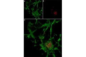 alpha-Bungarotoxin protein (Atto 633)