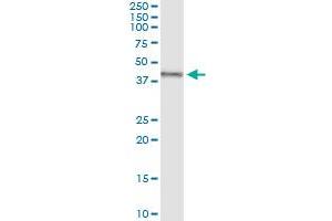 Immunoprecipitation of TRDMT1 transfected lysate using anti-TRDMT1 MaxPab rabbit polyclonal antibody and Protein A Magnetic Bead , and immunoblotted with TRDMT1 purified MaxPab mouse polyclonal antibody (B01P) . (Dnmt2 抗体  (AA 1-391))