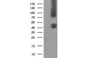Western Blotting (WB) image for anti-Gephyrin (GPHN) antibody (ABIN1498424) (Gephyrin 抗体)
