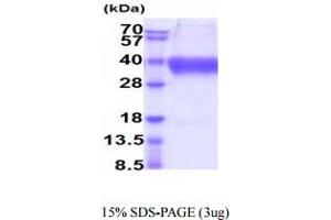 SDS-PAGE (SDS) image for V-Set Domain Containing T Cell Activation Inhibitor 1 (VTCN1) (AA 25-259) protein (His tag) (ABIN6388048) (VTCN1 Protein (AA 25-259) (His tag))