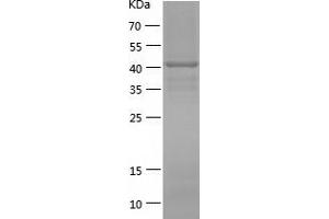 Western Blotting (WB) image for Fibroblast Growth Factor Receptor 1 (FGFR1) (AA 624-822) protein (His-IF2DI Tag) (ABIN7122955)