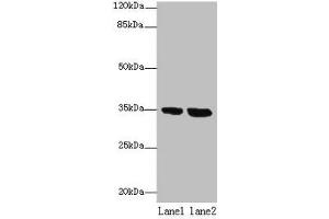 Western blot All lanes: TMEM165 antibody at 8 μg/mL Lane 1: Jurkat whole cell lysate Lane 2: Hela whole cell lysate Secondary Goat polyclonal to rabbit IgG at 1/10000 dilution Predicted band size: 35, 29 kDa Observed band size: 35 kDa (TMEM165 抗体  (AA 173-228))