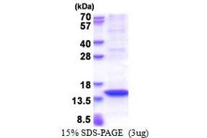 SDS-PAGE (SDS) image for MX dynamin like GTPase 2 (MX2) (AA 626-715) protein (His tag) (ABIN5853486) (MX2 Protein (AA 626-715) (His tag))
