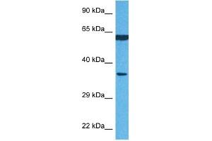 Host:  Rabbit  Target Name:  P4HB  Sample Tissue:  Human MCF7 Whole Cell  Antibody Dilution:  1ug/ml (P4HB 抗体  (N-Term))