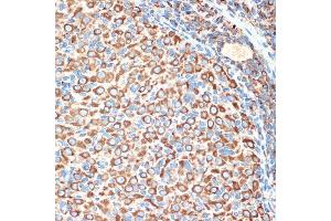 Immunohistochemistry of paraffin-embedded rat ovary using Slit2 Rabbit mAb (ABIN7270335) at dilution of 1:100 (40x lens). (SLIT2 抗体)