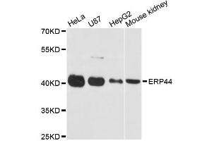 Western blot analysis of extracts of various cell lines, using ERP44 antibody (ABIN5972576) at 1:3000 dilution. (ERP44 抗体)