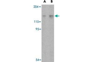 Western blot analysis of Rptor in L1210 cell lysate with Rptor polyclonal antibody  at (A) 2 and (B) 4 ug/mL . (Raptor 抗体  (C-Term))