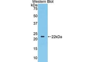 Western blot analysis of the recombinant protein. (TLR3 抗体  (AA 533-705))