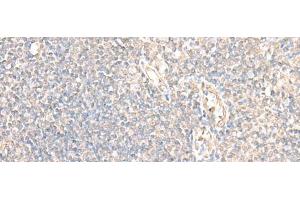 Immunohistochemistry of paraffin-embedded Human tonsil tissue using PARS2 Polyclonal Antibody at dilution of 1:30(x200) (PARS2 抗体)