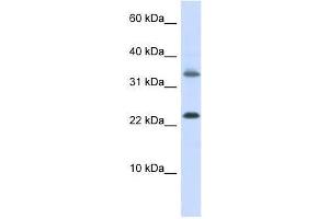 Western Blot showing EMX1 antibody used at a concentration of 1-2 ug/ml to detect its target protein.