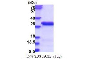 SDS-PAGE (SDS) image for RAN Binding Protein 3 (RANBP3) (AA 235-445) protein (His tag) (ABIN5853748) (RanBP3 Protein (AA 235-445) (His tag))