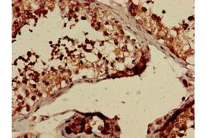 Immunohistochemistry of paraffin-embedded human testis tissue using ABIN7147850 at dilution of 1:100 (CLTCL1 抗体  (AA 1423-1566))