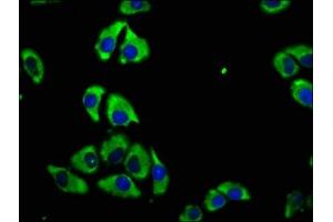Immunofluorescence staining of A549 cells with ABIN7147182 at 1:100, counter-stained with DAPI. (CD82 抗体  (AA 111-228))