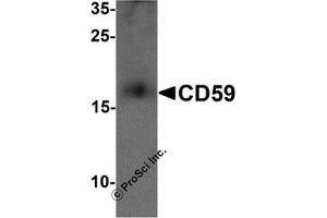 Western Blotting (WB) image for anti-CD59 (CD59) (N-Term) antibody (ABIN1077443) (CD59 抗体  (N-Term))