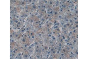 Used in DAB staining on fromalin fixed paraffin- embedded Kidney tissue (TIAM1 抗体  (AA 1261-1397))