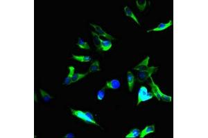 Immunofluorescent analysis of Hela cells using ABIN7173643 at dilution of 1:100 and Alexa Fluor 488-congugated AffiniPure Goat Anti-Rabbit IgG(H+L) (Tuberin 抗体  (AA 1396-1496))