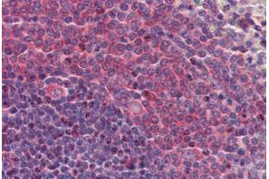 Human Spleen: Formalin-Fixed, Paraffin-Embedded (FFPE) (AAK1 抗体  (N-Term))