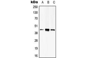 Western blot analysis of PSKH2 expression in Hela (A), HEK293T (B), mouse brain (C) whole cell lysates. (PSKH2 抗体  (Center))