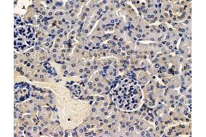 ABIN7096450 and ABIN7100514 at 1/100 staining mouse kidney tissue by IHC-P.