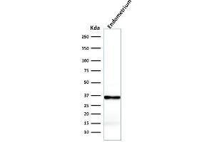 Western Blot Analysis of Endometrium lysate using Calponin-1 Recombinant Mouse Monoclonal Antibody (rCNN1/832). (Recombinant CNN1 抗体)