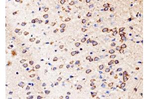 IHC analysis of Kinectin 1/KTN1 using anti-Kinectin 1/KTN1 antibody (ABIN7601096).