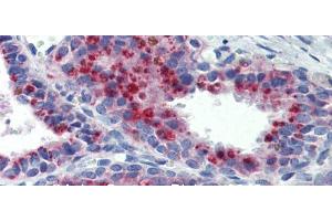 Immunohistochemistry (IHC) image for anti-Potassium Channel, Subfamily K, Member 9 (KCNK9) (N-Term) antibody (ABIN2776216)