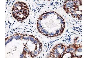 Immunohistochemical staining of paraffin-embedded Human breast tissue using anti-RBBP7 mouse monoclonal antibody. (RBBP7 抗体)
