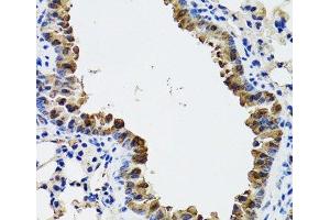 Immunohistochemistry of paraffin-embedded Mouse lung using ESD Polyclonal Antibody at dilution of 1:100 (40x lens). (Esterase D 抗体)