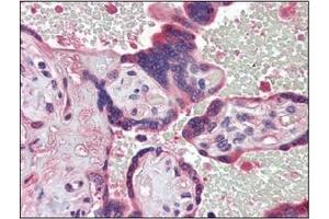 Immunohistochemistry (IHC) image for anti-Tyrosyl-DNA Phosphodiesterase 1 (TDP1) (AA 1-298), (N-Term) antibody (ABIN400858) (TDP1 抗体  (N-Term))