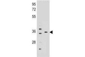 KCNRG antibody western blot analysis in mouse liver, lung tissue lysate