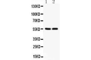 Anti- SLC2A1  Picoband antibody, Western blottingAll lanes: Anti SLC2A1  at 0. (GLUT1 抗体  (AA 92-492))