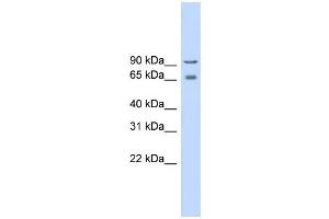 WB Suggested Anti-CACNB2 Antibody Titration:  0. (CACNB2 抗体  (Middle Region))