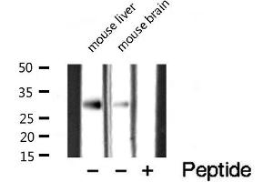 Western blot analysis of extracts of various tissue sample,using CTDSP1 Antibody .