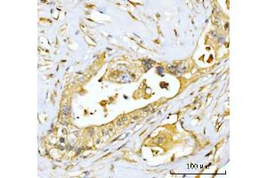 IHC analysis of EIF3E using anti-EIF3E antibody (ABIN7600190). (EIF3E 抗体  (AA 160-249))