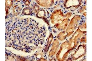 Immunohistochemistry of paraffin-embedded human kidney tissue using ABIN7175662 at dilution of 1:100 (SORCS2 抗体  (AA 712-786))
