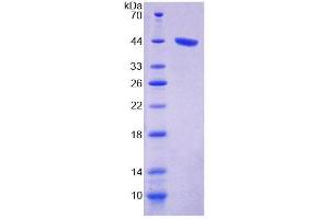 SDS-PAGE analysis of Human PKCd Protein. (PKC delta 蛋白)
