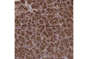 Immunohistochemical staining of human pancreas with TRIP11 polyclonal antibody  shows strong cytoplasmic positivity with a granular pattern in exocrine glandular cells. (Thyroid Hormone Receptor Interactor 11 (TRIP11) 抗体)