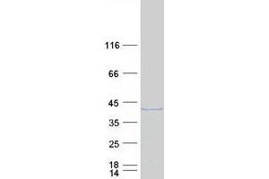 Western Blotting (WB) image for GTP Binding Protein Overexpressed in Skeletal Muscle (GEM) (Transcript Variant 2) protein (Myc-DYKDDDDK Tag) (ABIN2721788)
