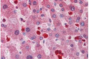 Human Liver: Formalin-Fixed, Paraffin-Embedded (FFPE) (GCLM 抗体  (AA 182-231))