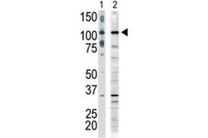 Western Blotting (WB) image for anti-Mitogen-Activated Protein Kinase Kinase Kinase 9 (MAP3K9) antibody (ABIN3003574) (MAP3K9 抗体)