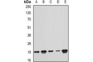 Western blot analysis of PTRH2 expression in MCF7 (A), A549 (B), mouse liver (C), mouse spleen (D), rat brain (E) whole cell lysates. (PTRH2 抗体)