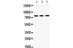 Western Blotting (WB) image for anti-Matrix Metallopeptidase 9 (Gelatinase B, 92kDa Gelatinase, 92kDa Type IV Collagenase) (MMP9) (AA 641-672), (C-Term) antibody (ABIN3043884) (MMP 9 抗体  (C-Term))
