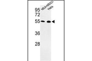 Western blot analysis of EGLN2 Antibody (Center) (ABIN652648 and ABIN2842435) in MDA-M, Hela cell line lysates (35 μg/lane). (PHD1 抗体  (AA 194-221))